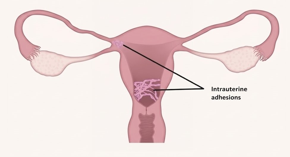 Hysteroscopy Near Me