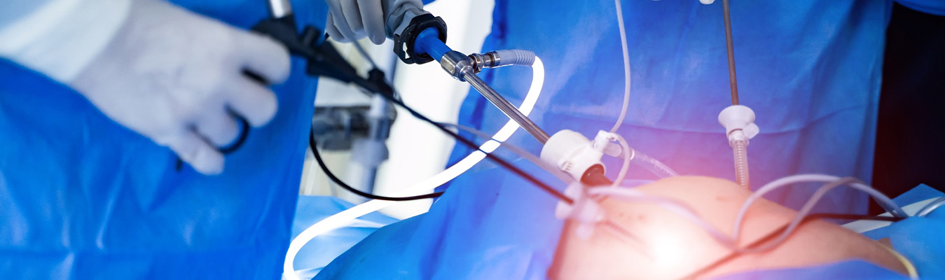 Laparoscopy Banner