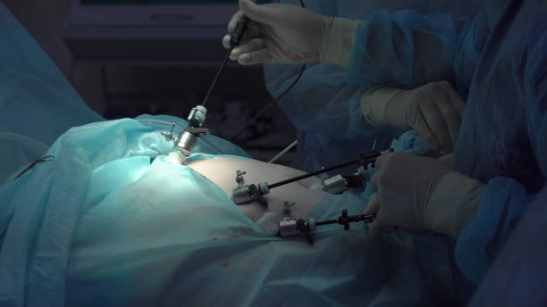 Laparoscopy Surgical Procedure